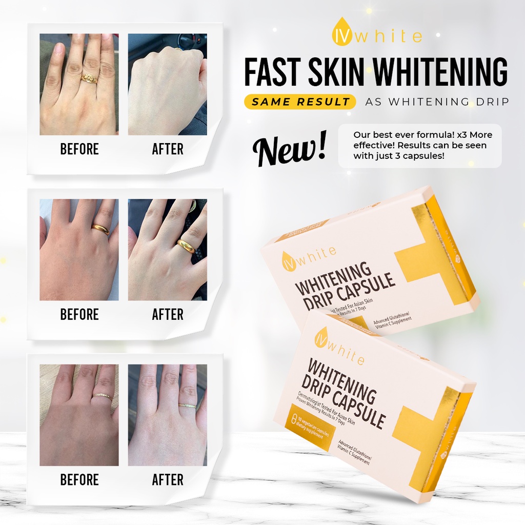 IvWhite KOREA Whitening Drip Capsule Supplement (HIGHLY EFFECTIVE) Glowing Skin Booster